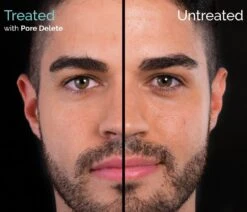 Hylamide Pore Delete 30ml 5 Hylamide Pore Delete 30ml -Selected Baby Products Stores screenshot 2019 02 10 hylamide multi depth skin care a deciem brand